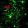 research:pjd17:microglia.jpg